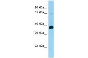 Image no. 1 for anti-Snurportin 1 (SNUPN) (AA 24-73) antibody (ABIN6748330) (Snurportin 1 antibody  (AA 24-73))