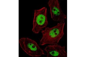 Immunofluorescence (IF) image for anti-Paired-Like Homeobox 2b (PHOX2B) antibody (ABIN2996148)