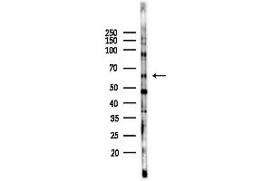 anti-Zinc Finger Protein 280B (ZNF280B) (C-Term) antibody