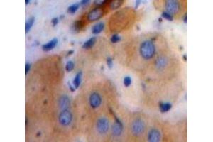 #VALUE! (C19ORF80 antibody  (AA 24-196))