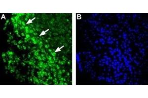 Expression of Histamine H1 receptor in mouse brainImmunohistochemical staining of mouse ventromedial hypothalamus (VMH) using Anti-Histamine H1 Receptor (HRH1) Antibody (ABIN7043268, ABIN7044505 and ABIN7044506). (Histamine Receptor H1 (HRH1) Peptide)