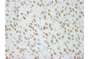 Immunohistochemistry (IHC) image for anti-DEAD (Asp-Glu-Ala-Asp) Box Polypeptide 21 (DDX21) (C-Term) antibody (ABIN7448516)