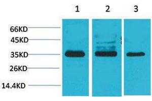 Western Blotting (WB) image for anti-Calcium Channel, Voltage-Dependent, gamma Subunit 4 (CACNG4) antibody (ABIN3181550)