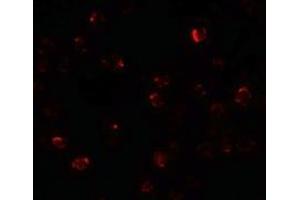 Immunofluorescence of ZBTB40 in Raji cells with ZBTB40 antibody at 20 µg/ml.