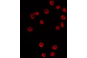 ABIN6266525 staining Hela by IF/ICC. (Cyclin G1 antibody  (Internal Region))