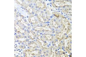 Immunohistochemistry of paraffin-embedded rat kidney using LRP2 antibody (ABIN1680712, ABIN3017881, ABIN3017882 and ABIN6220293) at dilution of 1:100 (40x lens). (LRP2 antibody  (AA 4446-4655))