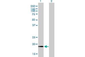 Western Blot analysis of CETN2 expression in transfected 293T cell line by CETN2 MaxPab polyclonal antibody.