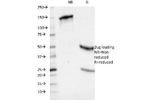 SDS-PAGE Analysis Purified HLA-ABC Mouse Monoclonal Antibody (246-B8. (HLA-ABC antibody)