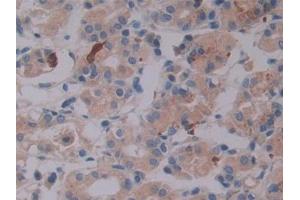 DAB staining on IHC-P; Samples: Human Stomach Tissue (LTBP2 antibody  (AA 522-814))