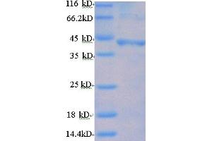 SDS-PAGE (SDS) image for Follicle Stimulating Hormone Receptor (FSHR) (AA 18-366), (Extracellular) protein (His tag) (ABIN5709537) (FSHR Protein (AA 18-366, Extracellular) (His tag))