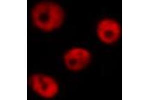 Immunofluorescence (fixed cells) (IF/ICC) image for anti-Checkpoint Kinase 2 (CHEK2) (pThr68) antibody (ABIN6256592)