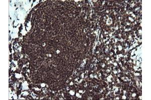 Image no. 2 for anti-V-Ets Erythroblastosis Virus E26 Oncogene Homolog 2 (ETS2) (AA 90-349) antibody (ABIN1491703) (ETS2 antibody  (AA 90-349))