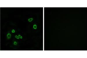 Immunofluorescence analysis of A549 cells, using BRP44L antibody. (BRP44L antibody)