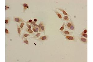 Immunocytochemistry analysis of Hela cells using ABIN7139204 at dilution of 1:100 (HIST1H3A antibody  (acLys9))