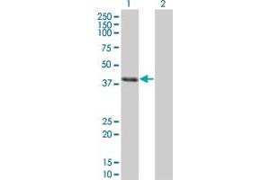 Western Blot analysis of CLN3 expression in transfected 293T cell line by CLN3 monoclonal antibody (M03), clone 1G10.