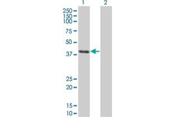 CLN3 Antikörper  (AA 1-438)