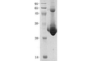 Validation with Western Blot (PSPH Protein (His tag))