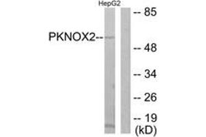 Western blot analysis of extracts from HepG2 cells, using PKNOX2 Antibody. (PKNOX2 antibody  (AA 341-390))