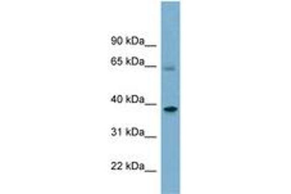 Sorting Nexin 7 抗体  (AA 359-408)
