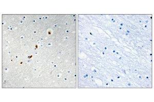 Immunohistochemistry (IHC) image for anti-Zinc Finger Protein 596 (ZNF596) (Internal Region) antibody (ABIN1849812)