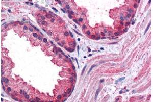 Human Prostate: Formalin-Fixed, Paraffin-Embedded (FFPE) (CCNDBP1 antibody  (AA 348-360))