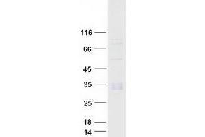 Validation with Western Blot (C1QB Protein (Myc-DYKDDDDK Tag))