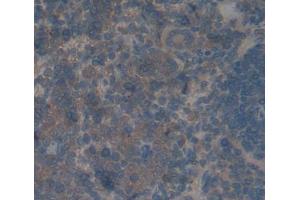 Used in DAB staining on fromalin fixed paraffin- embedded spleen tissue (GADD34 antibody  (Regulatory Subunit 15A))