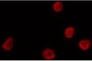 ABIN6275719 staining Hela by IF/ICC. (SMUG1 antibody  (Internal Region))