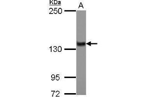 WB Image Sample (30 ug of whole cell lysate) A: IMR32 5% SDS PAGE antibody diluted at 1:1000 (ZNF217 antibody)
