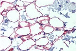Adipocytes, Human: Formalin-Fixed, Paraffin-Embedded (FFPE) (NFIC antibody  (AA 323-372))