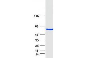 Western Blotting (WB) image for Annexin A11 (ANXA11) (Transcript Variant A) protein (Myc-DYKDDDDK Tag) (ABIN2714732)