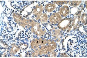 Human kidney (PPAP2A antibody  (N-Term))