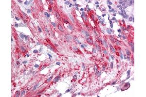 Immunohistochemistry (IHC) image for anti-Sirtuin 5 (SIRT5) (Middle Region) antibody (ABIN405300) (SIRT5 antibody  (Middle Region))