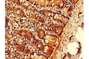 Immunohistochemistry of paraffin-embedded human small intestine tissue using ABIN7151962 at dilution of 1:100 (EPN3 antibody  (AA 25-208))
