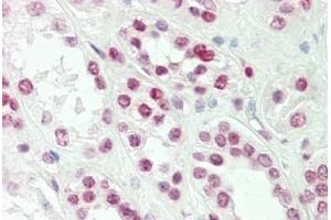 Human Kidney: Formalin-Fixed, Paraffin-Embedded (FFPE) (TLX1 antibody  (AA 163-191))