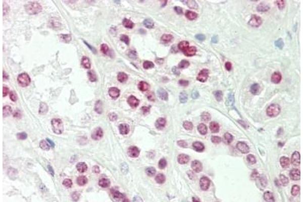 TLX1 antibody  (AA 163-191)