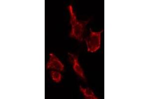 ABIN6275173 staining LOVO cells by IF/ICC. (SAR1B antibody  (Internal Region))