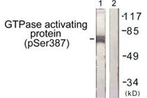Western blot analysis of extracts from COS7 cells, using GTPase Activating Protein (Phospho-Ser387) Antibody. (RACGAP1 antibody  (pSer387))