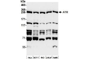 Western Blotting (WB) image for anti-ATR serine/threonine kinase (ATR) (AA 1675-1725) antibody (ABIN7451652)