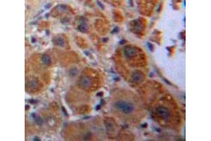 Used in DAB staining on fromalin fixed paraffin-embedded Liver tissue (KNG1 antibody  (AA 22-379))
