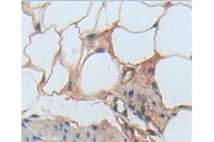 IHC-P analysis of Kidney tissue, with DAB staining. (TLR5 antibody  (AA 325-644))