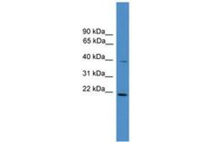 Image no. 1 for anti-DnaJ (Hsp40) Homolog, Subfamily B, Member 4 (DNAJB4) (AA 210-259) antibody (ABIN6745425)