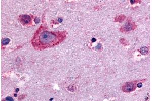 Anti-Delta Opioid Receptor antibody  ABIN1048497 IHC staining of human brain, neurons and glia. (OPRD1 antibody  (C-Term))