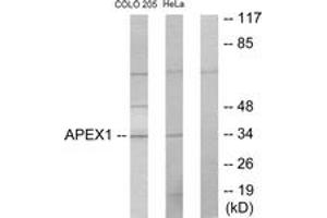 Western blot analysis of extracts from COLO205/HeLa cells, using APEX1 Antibody. (APEX1 antibody  (AA 191-240))