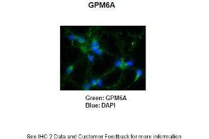 Primary Antibody Dilution: 1:250Secondary Antibody: Anti-rabbit-AlexaFluor 488 Secondary Antibody Dilution: 1:5000Color/Signal Descriptions: GPM6A: Green DAPI: Blue  Gene Name: GPM6A Submitted by: Anonymous (GPM6A antibody  (C-Term))