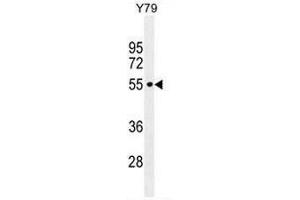 CCDC97 Antibody (C-term) western blot analysis in Y79 cell line lysates (35µg/lane). (CCDC97 antibody  (C-Term))