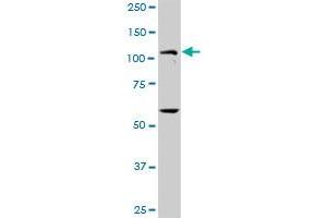 PKN1 MaxPab rabbit polyclonal antibody. (PKN1 antibody  (AA 1-942))