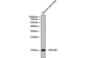 Western blot analysis of extracts of Mouse pancreas using RNASE1 Polyclonal Antibody at dilution of 1:1000. (RNASE1 antibody)