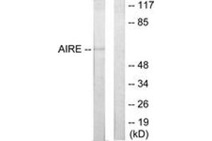 Western blot analysis of extracts from 293 cells, using AIRE Antibody. (AIRE antibody  (AA 91-140))