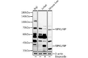 Western blot analysis of extracts of various cell lines, using RIPK1/RIP antibody (ABIN6132596, ABIN6146959, ABIN6146960 and ABIN6223282) at 1:1000 dilution. (RIPK1 antibody  (AA 170-440))
